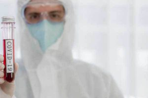 فيروس كورونا: أبحاث ودراسات جديدة